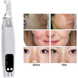 Neatcell Picoseconde Laserpen – Professionele Tattoo- en Pigmentverwijderaar, Blauw LED Licht, 9 Frequenties, 4 Energie-instellingen – Voor Verwijdering van Sproeten, Donkere Vlekken en Melanine, 110–240V