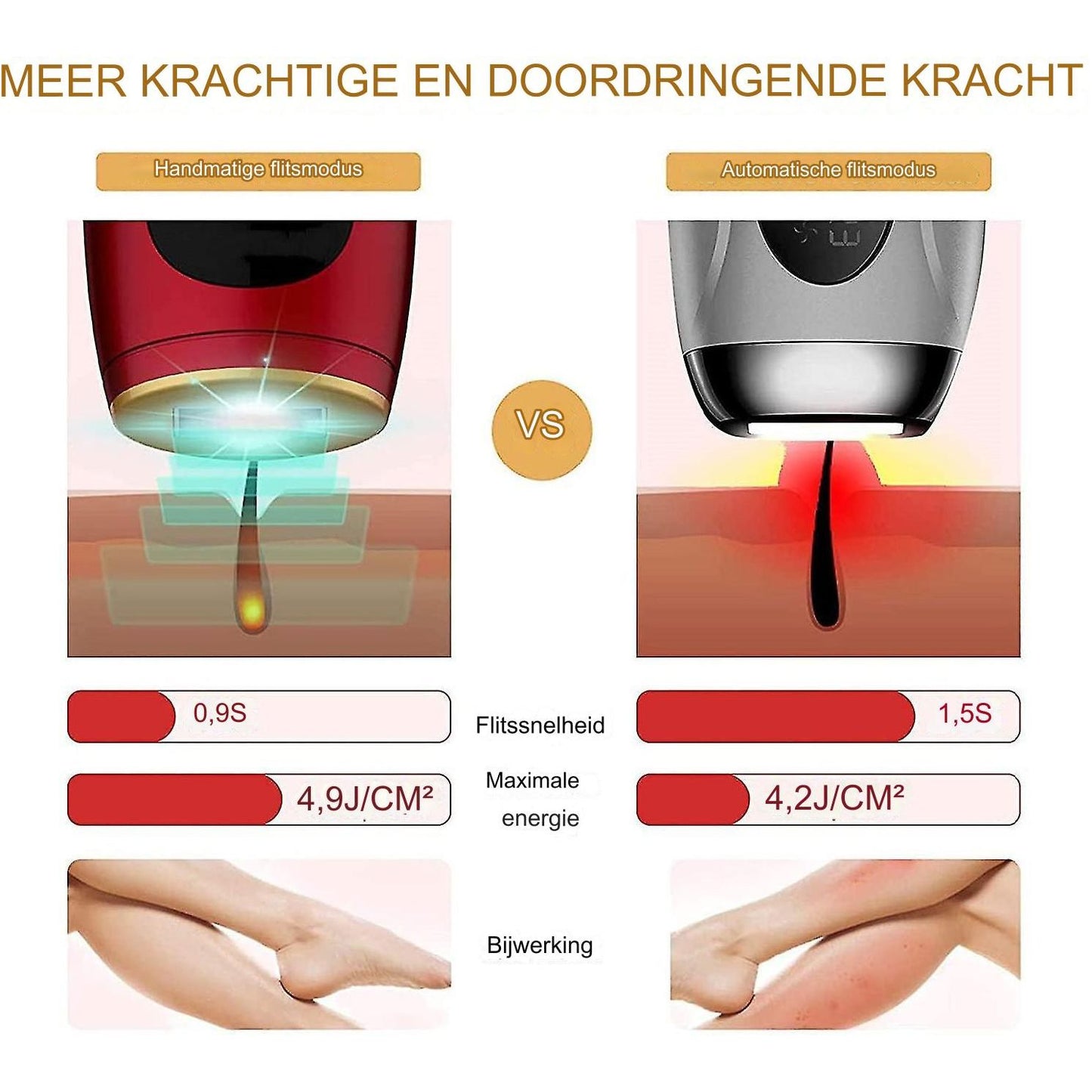 IPL Laser Ontharingsapparaat - 5 Niveau's - Permanente & Pijnloze Haarverwijdering - 999,999 Flitsen - 5 Energie Levels - Rood - Geschikt voor Gehele Lichaam