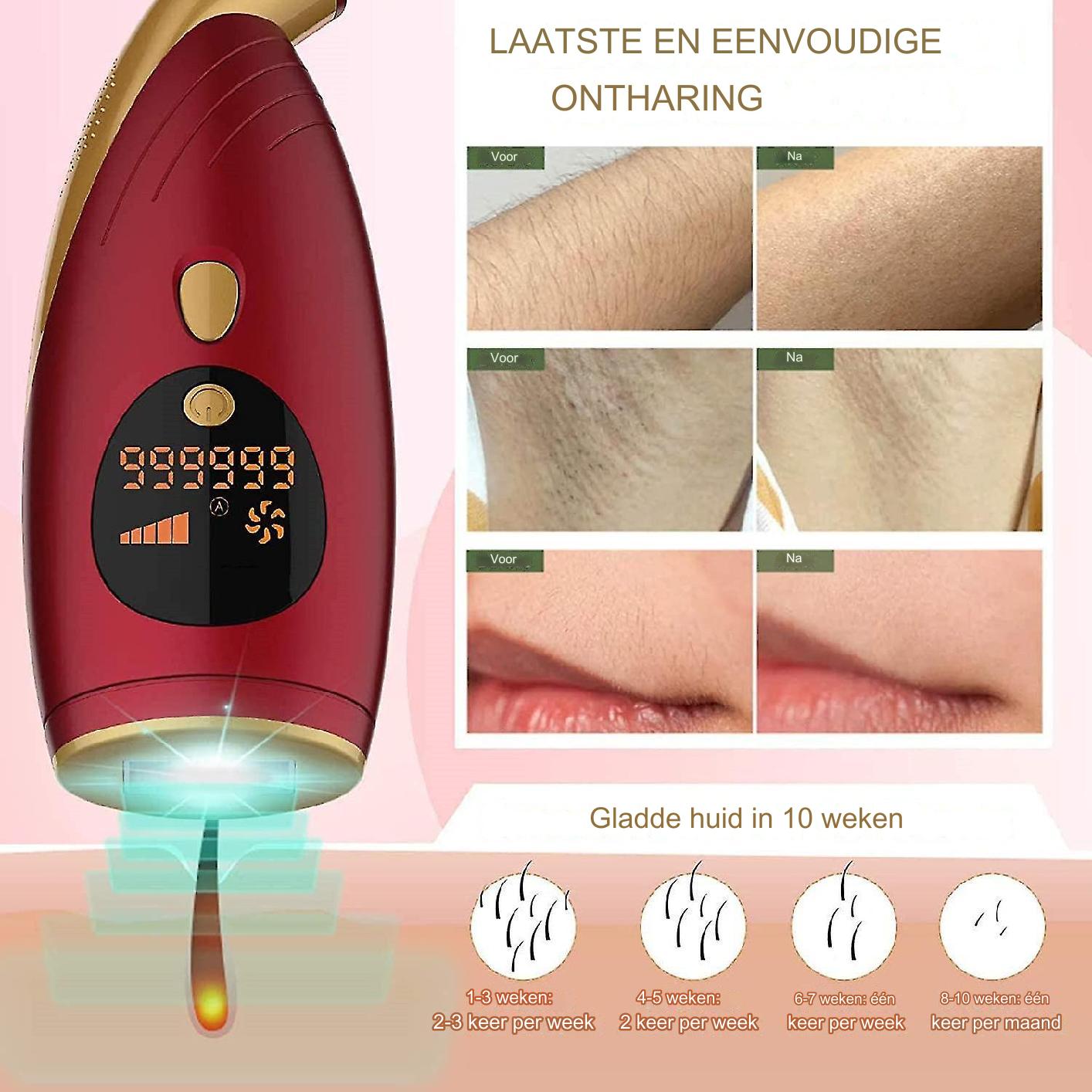 IPL Laser Ontharingsapparaat - 5 Niveau's - Permanente & Pijnloze Haarverwijdering - 999,999 Flitsen - 5 Energie Levels - Rood - Geschikt voor Gehele Lichaam