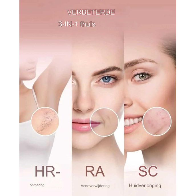 IPL Laser Ontharingsapparaat – Permanent Haarverwijderingssysteem – 36W – 5 cm² Bestralingsoppervlakte – 9 Energieniveaus – Geschikt Voor Gezicht en Lichaam – Huidverjonging en Acnebehandeling