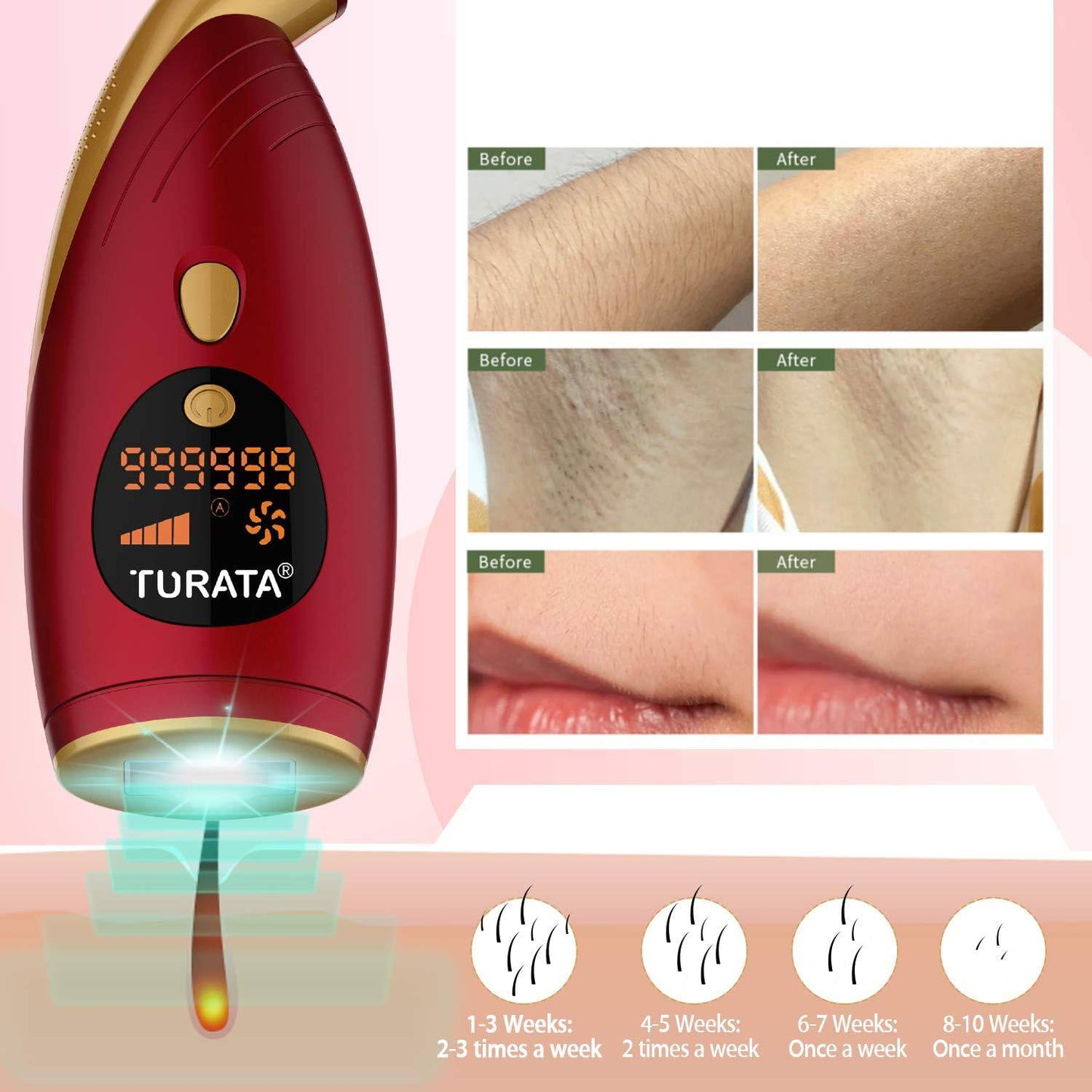 IPL Laser Ontharingsapparaat - 5 Niveau's - Permanente & Pijnloze Haarverwijdering - 999,999 Flitsen - 5 Energie Levels - Rood - Geschikt voor Gehele Lichaam