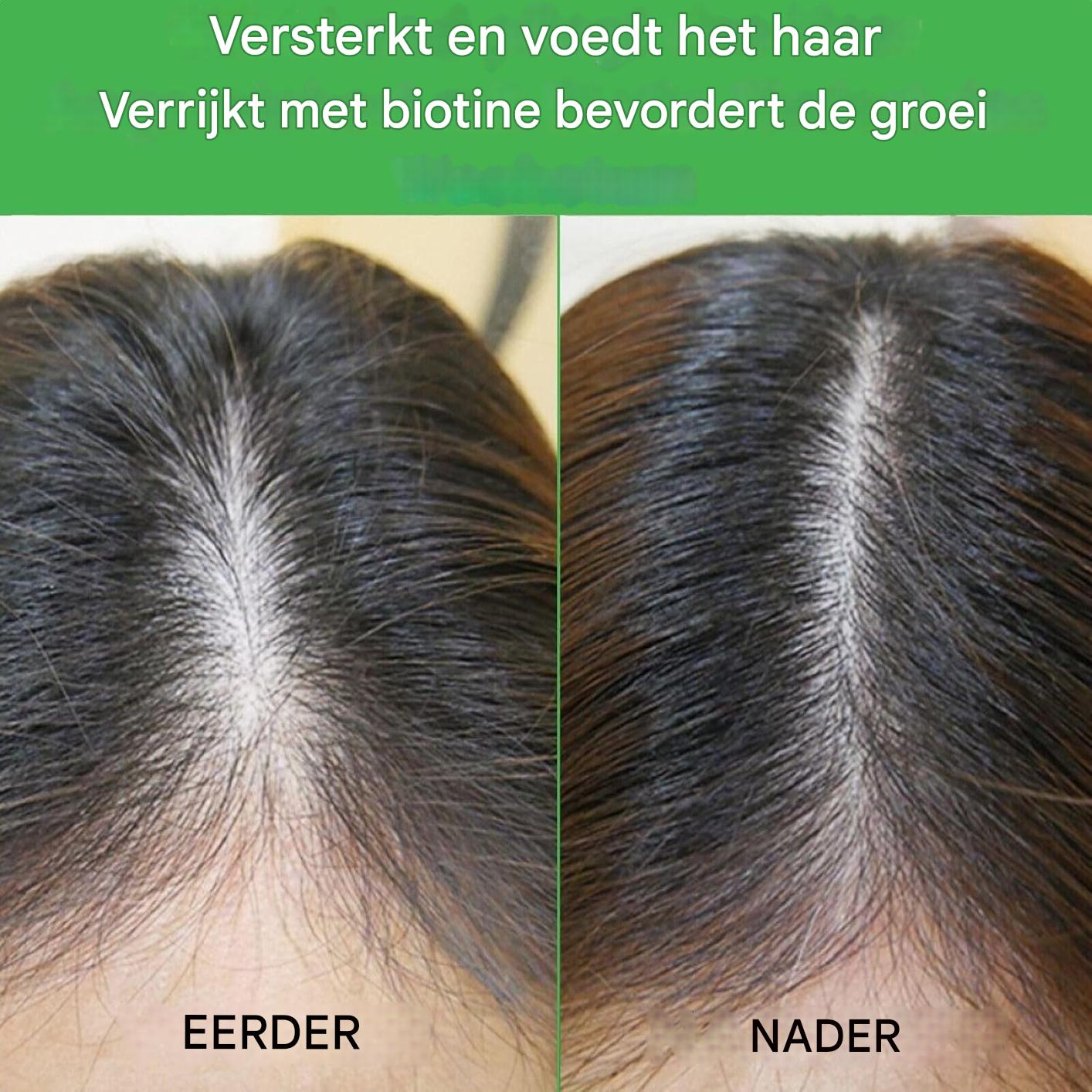 Rozemarijn Shampoo voor Haargroei – 300 ml – Anti-Haaruitval Shampoo – Versterkend en Voedend – Voor Alle Haartypes – Vegan en Natuurlijk