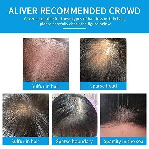 Aliver - Haarvezels Voor Dunner Wordend Haar -  Natuurlijke Formule - Dikker Voller Haar In 15 Seconden - Verbergt Haaruitval - Unisex 0.97Oz - Zwart